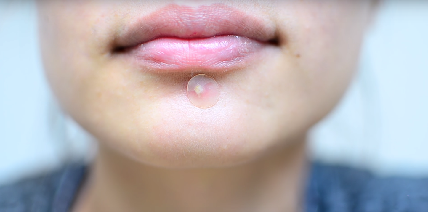 Overnight Spot Acne Patches ( 40 Clear Patches )