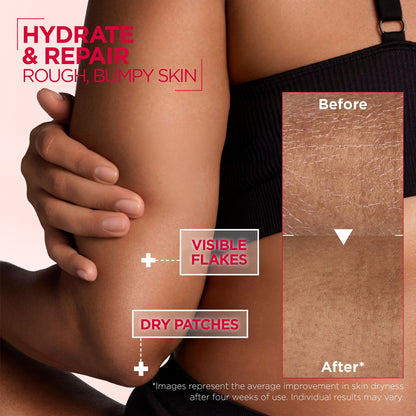 Mixa Urea Cica Repair+ 10% Renewing Cream 400ml