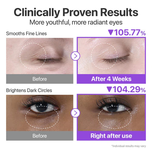 Numbuzin No.9 NAD Retinol Volumetox Eye Cream 10ml