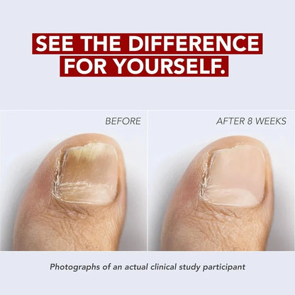 Kerasal Fungal Nail Renewal 10 ml