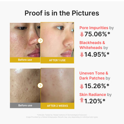 Medicube Peel Shot Kojic Acid & Turmeric Exfoliating Peel 80 ml