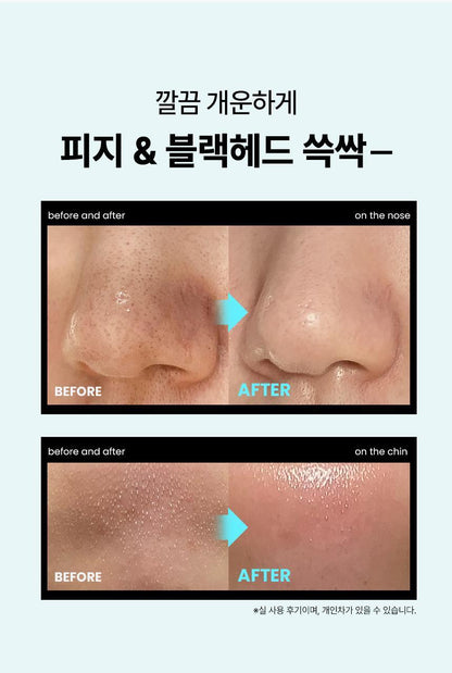 ILSO Super Melting Sebum SET