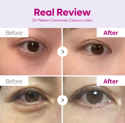 Dr . Melaxin Calcium cx Cemenrete Volume Cream 50g