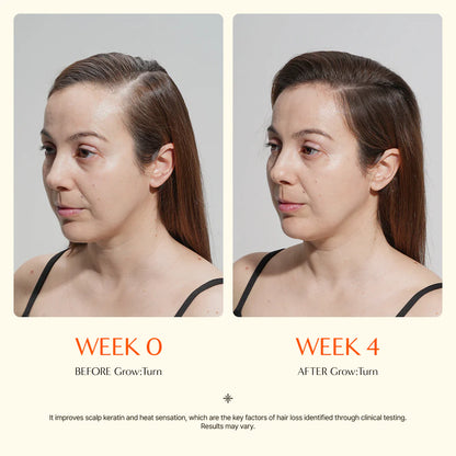 lilyeve Grow:Turn Exosome Brush Ampoule Full Course x 3 treatments