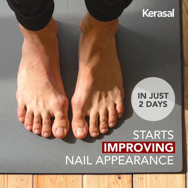 Kerasal Fungal Nail Renewal 10 ml