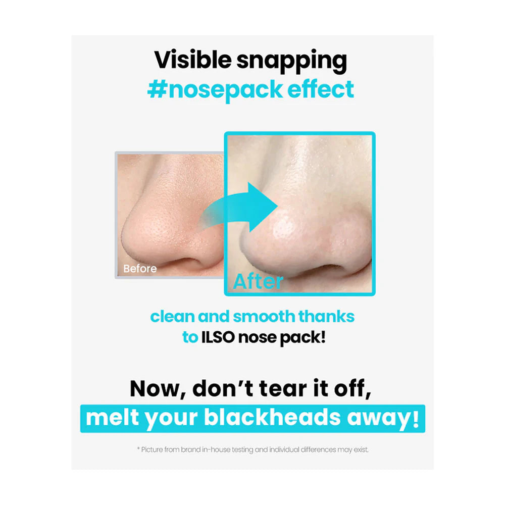 ILSO Super Melting Sebum SET with Natural Mild Clear Nose Patch 5ea