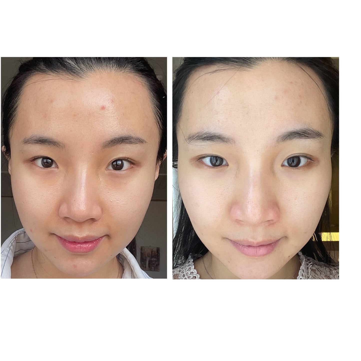 I'm From , Rice serum , 30 ml
