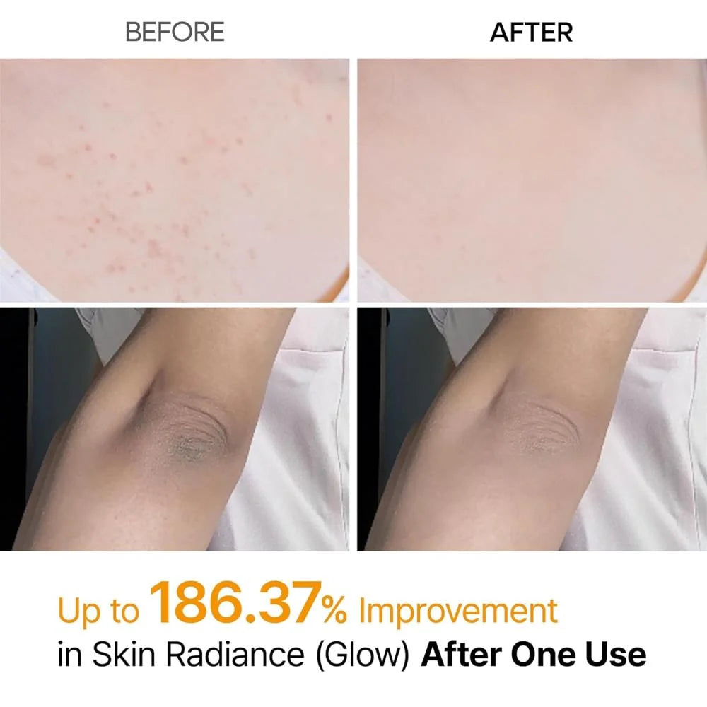 Dr. Melaxin Kojic Acid & Turmeric peeling  Body Scrub Spray 200ml