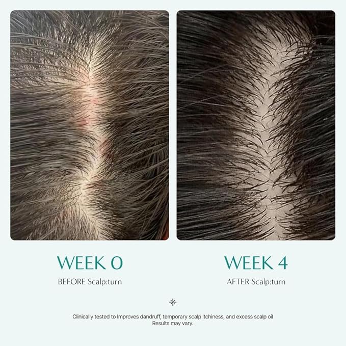 Lilyeve Scalpturn Cica PDRN Brush Serum Full Course x 3 treatments