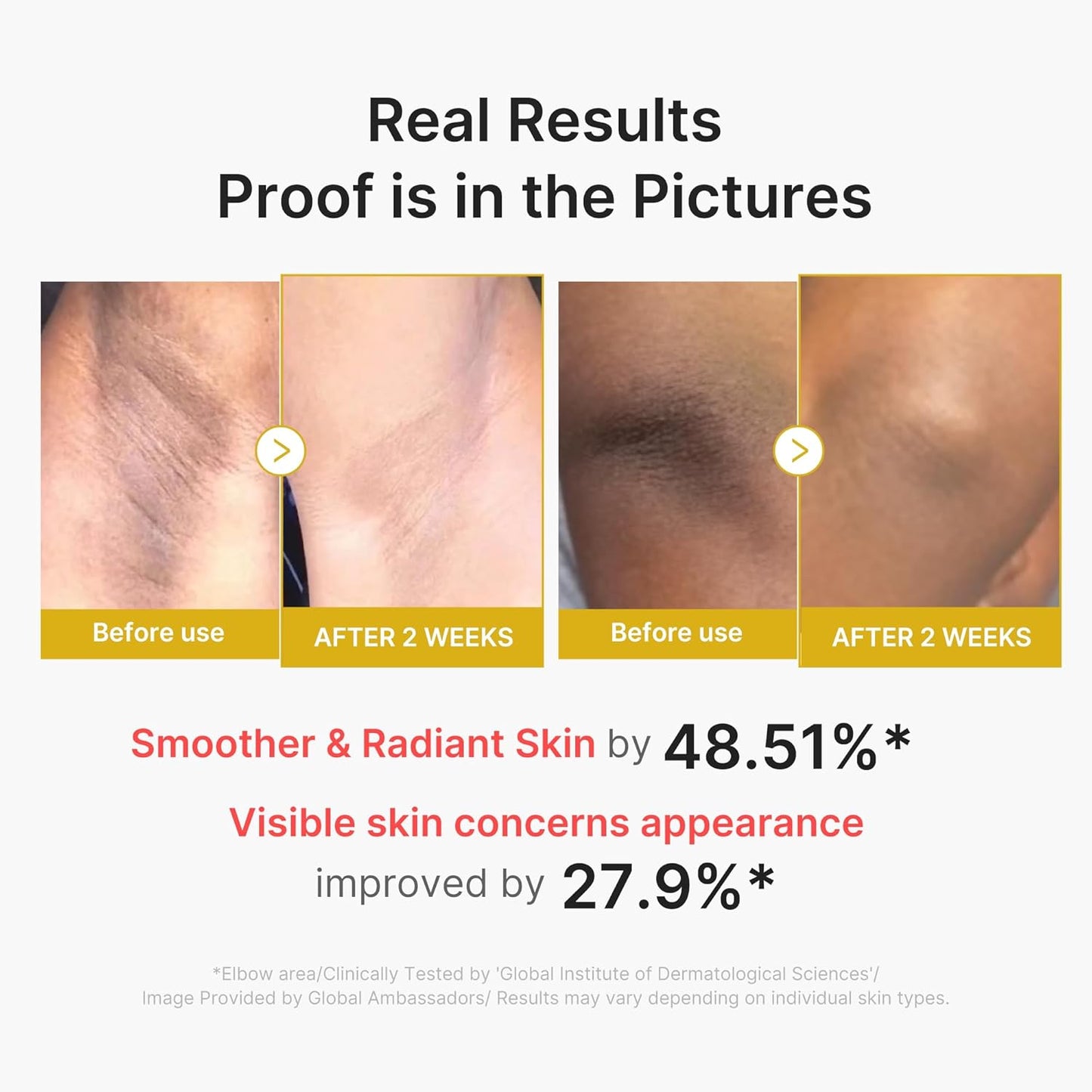 Medicube Kojic Acid Turmeric Body Peel Shot 280ml