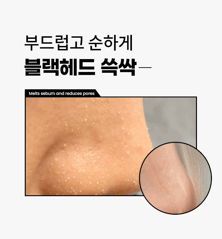 ILSO Super Melting Sebum SET