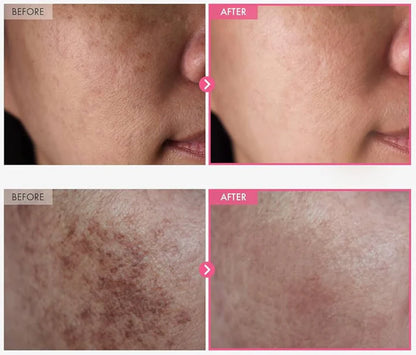 Tosowoong Arbutin 7% + Tranexamic Acid 4% Cream 50ml