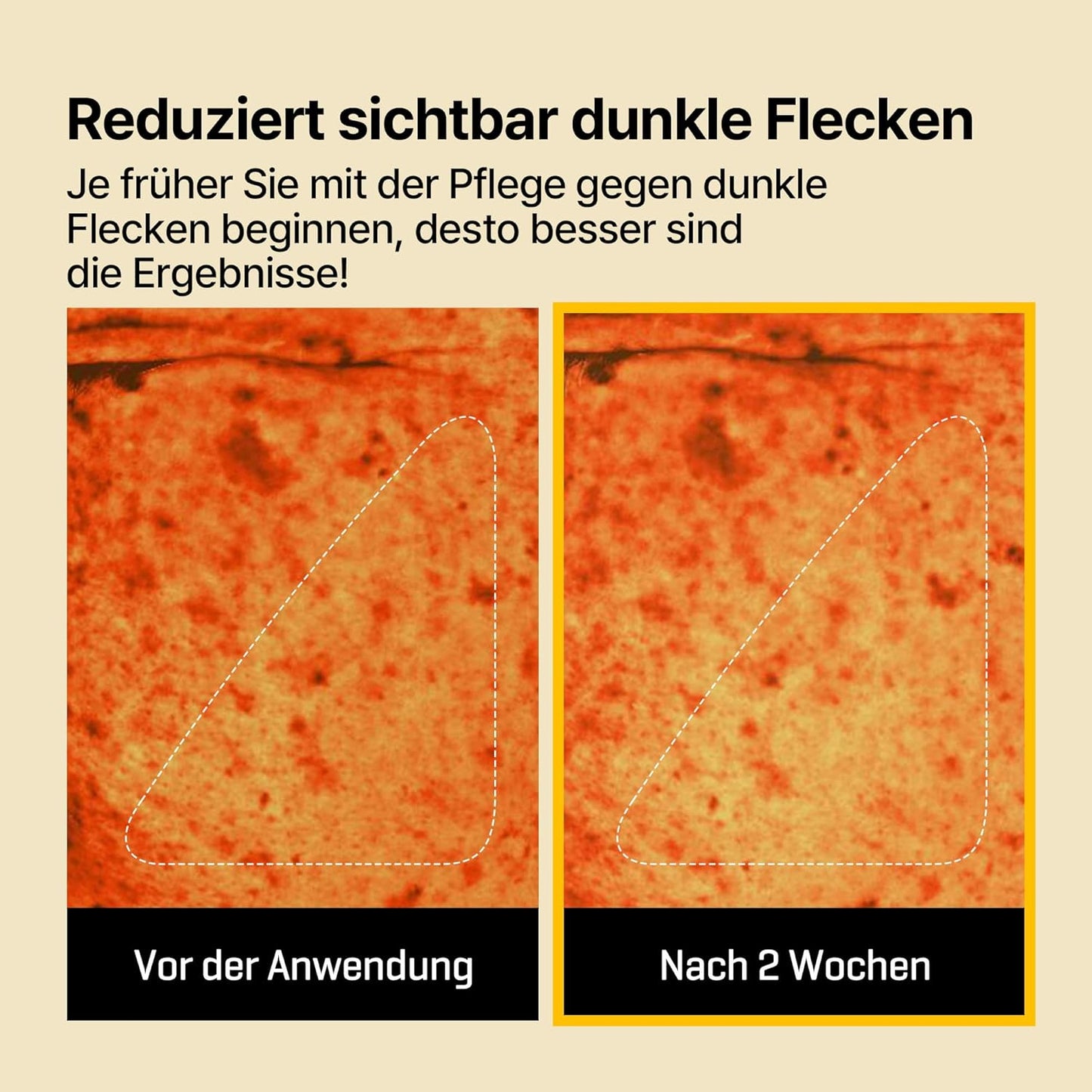 Some By Mi Yuja Niacin Anti Blemish Daily Mask 30 Sheets