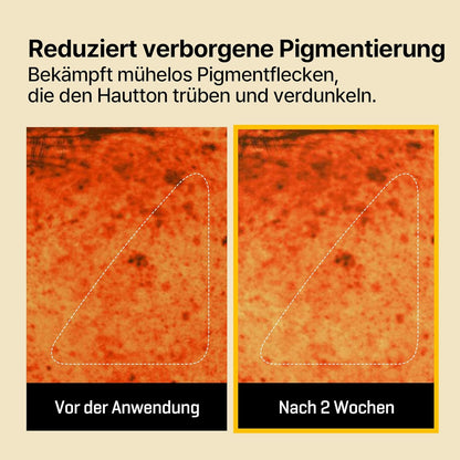 Some By Mi Yuja Niacin Anti Blemish Daily Mask 30 Sheets