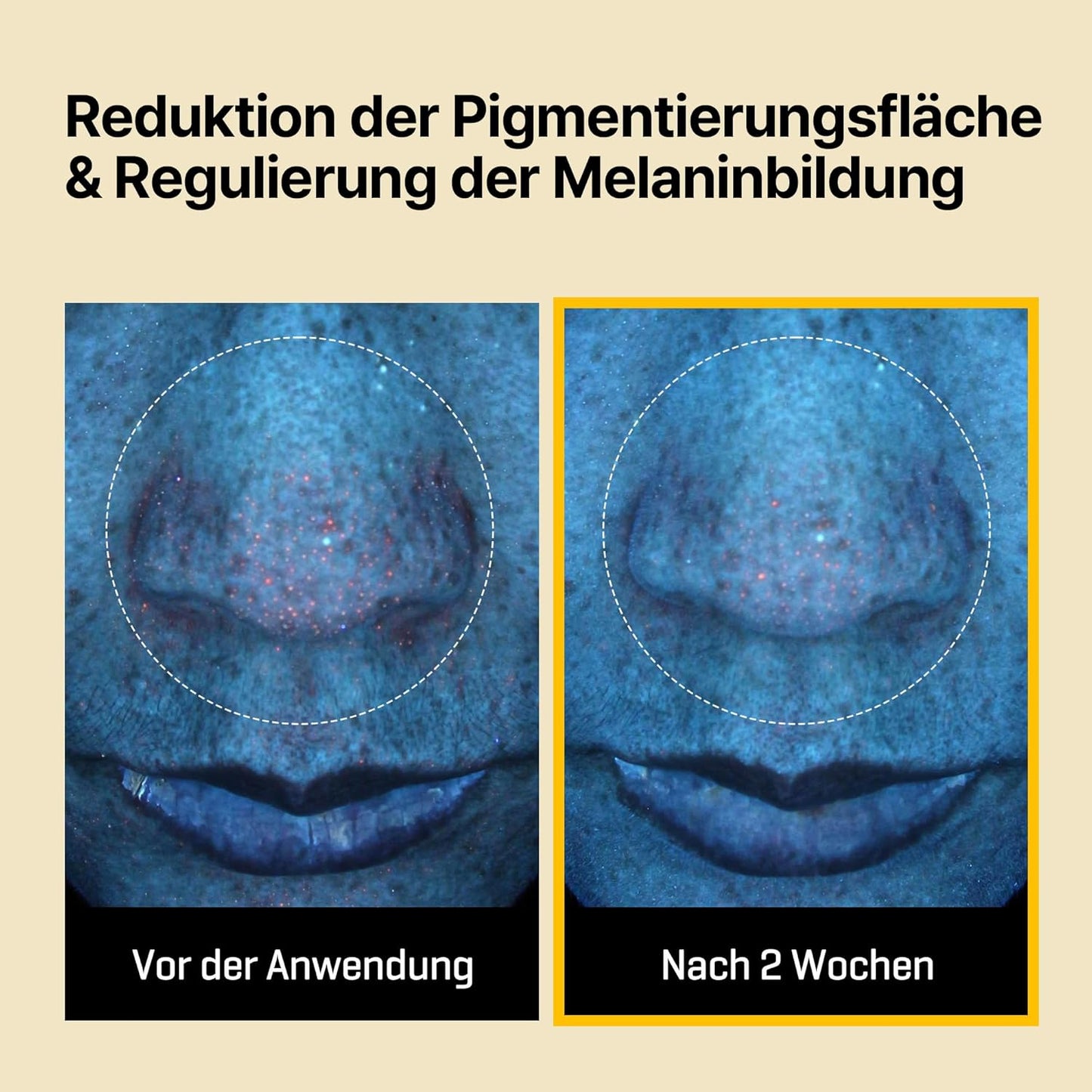 Some By Mi Yuja Niacin Anti Blemish Daily Mask 30 Sheets