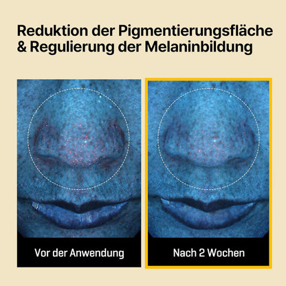 Some By Mi Yuja Niacin Anti Blemish Daily Mask 30 Sheets