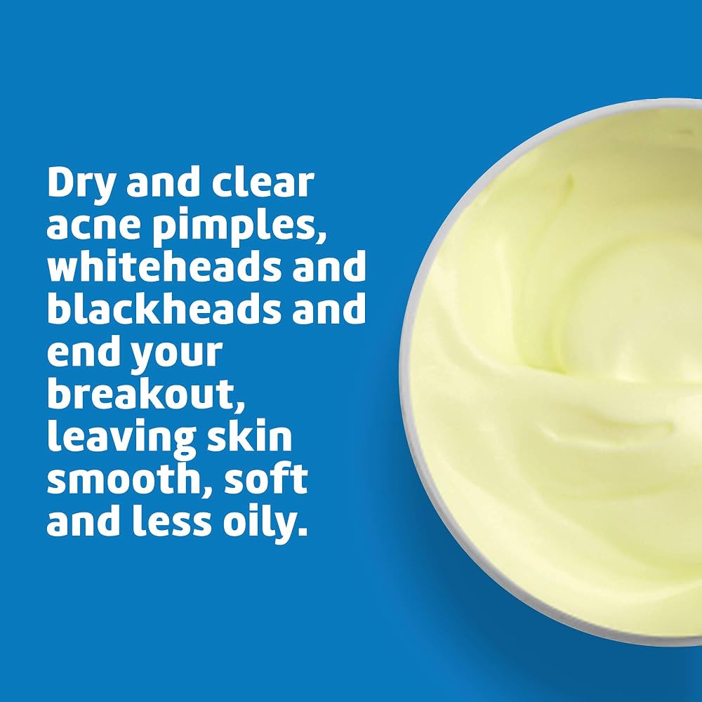 De La Cruz , Acne Treatment Ointment with 10% Sulfur, Maximum Strength , (73.7 g)