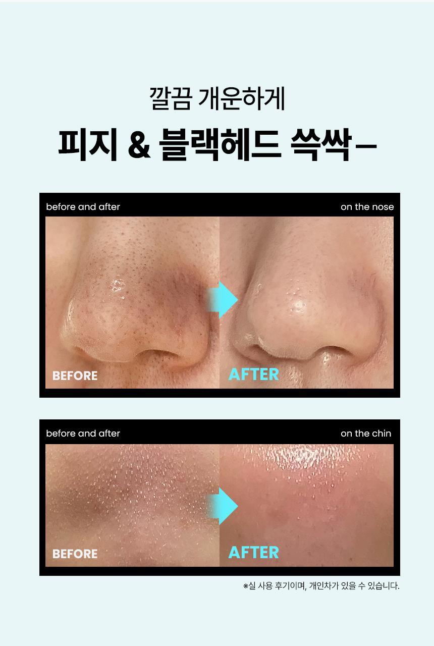 ILSO Super Melting Sebum SET with Natural Mild Clear Nose Patch 5ea