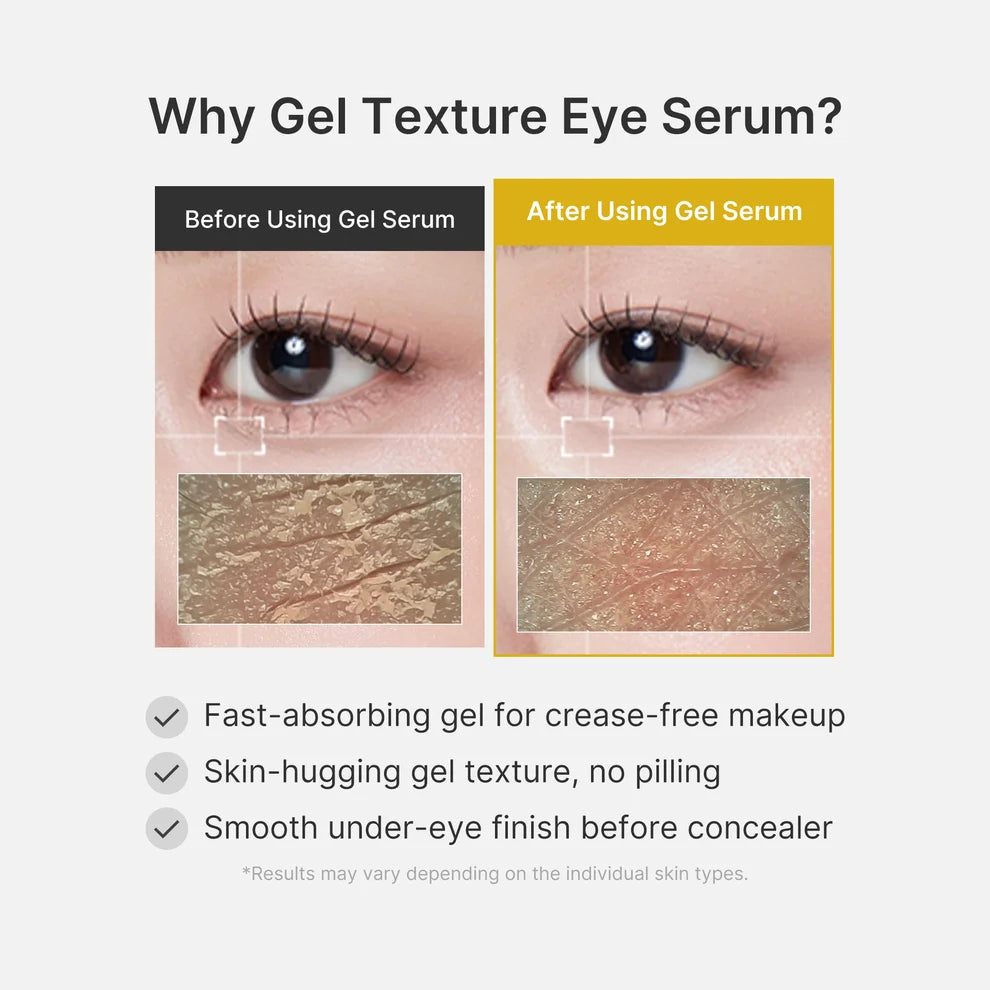 Medicube Kojic Acid Turmeric Eye Gel Serum 30ml