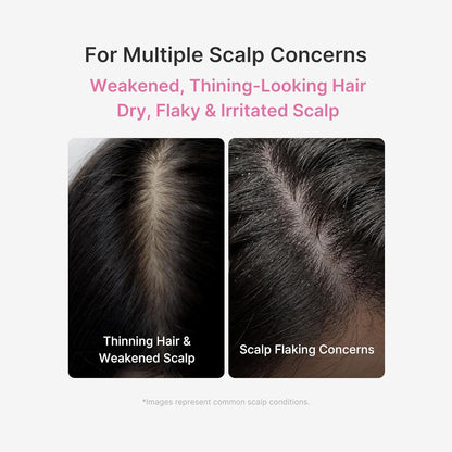 Medicube Rosemary PDRN Full Scalp Care Set of 3 (Shampoo, Conditioner, Scalp serum)