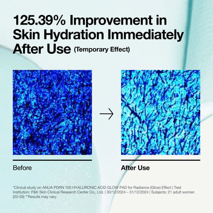 Anua , PDRN 100 Hyaluronic Acid Glow Pad , 60 pads , 180 ml