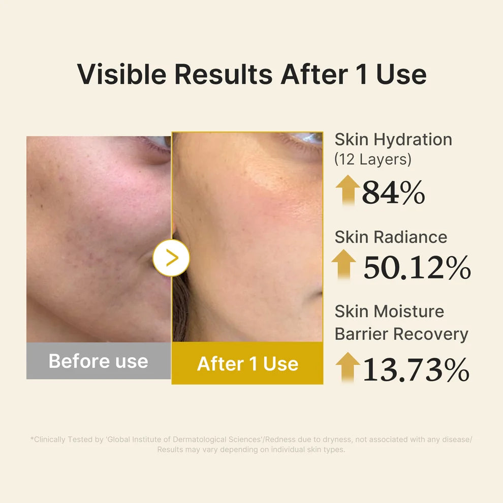 Medicube Kojic Acid Turmeric Vitamin Gold Jelly Mist Serum 100ml