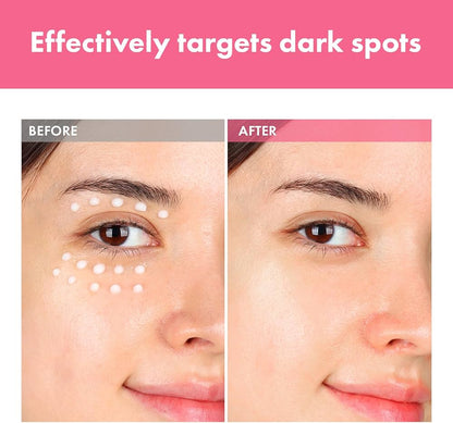 Tosowoong Arbutin 7.0 Intensive Spot Cream 20ml