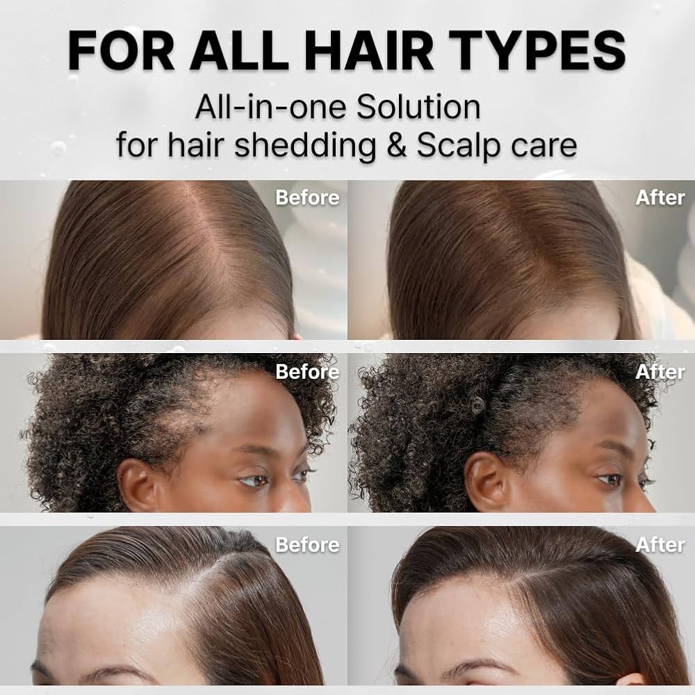 lilyeve Grow:Turn Exosome Brush Ampoule Full Course x 3 treatments