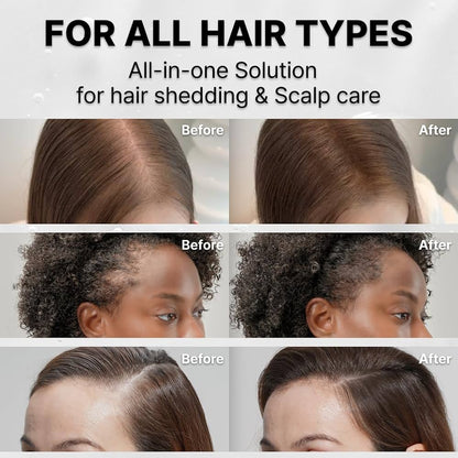 lilyeve Grow:Turn Exosome Brush Ampoule Full Course x 3 treatments