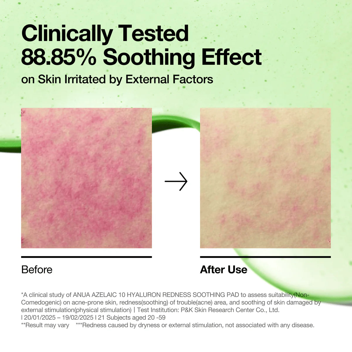 Anua Azelaic Acid 10 Hyaluron Redness Soothing Pad (90 Pads)