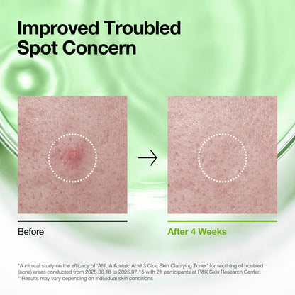 Anua Azelaic 3 Cica Skin Clarifying Toner 250ml