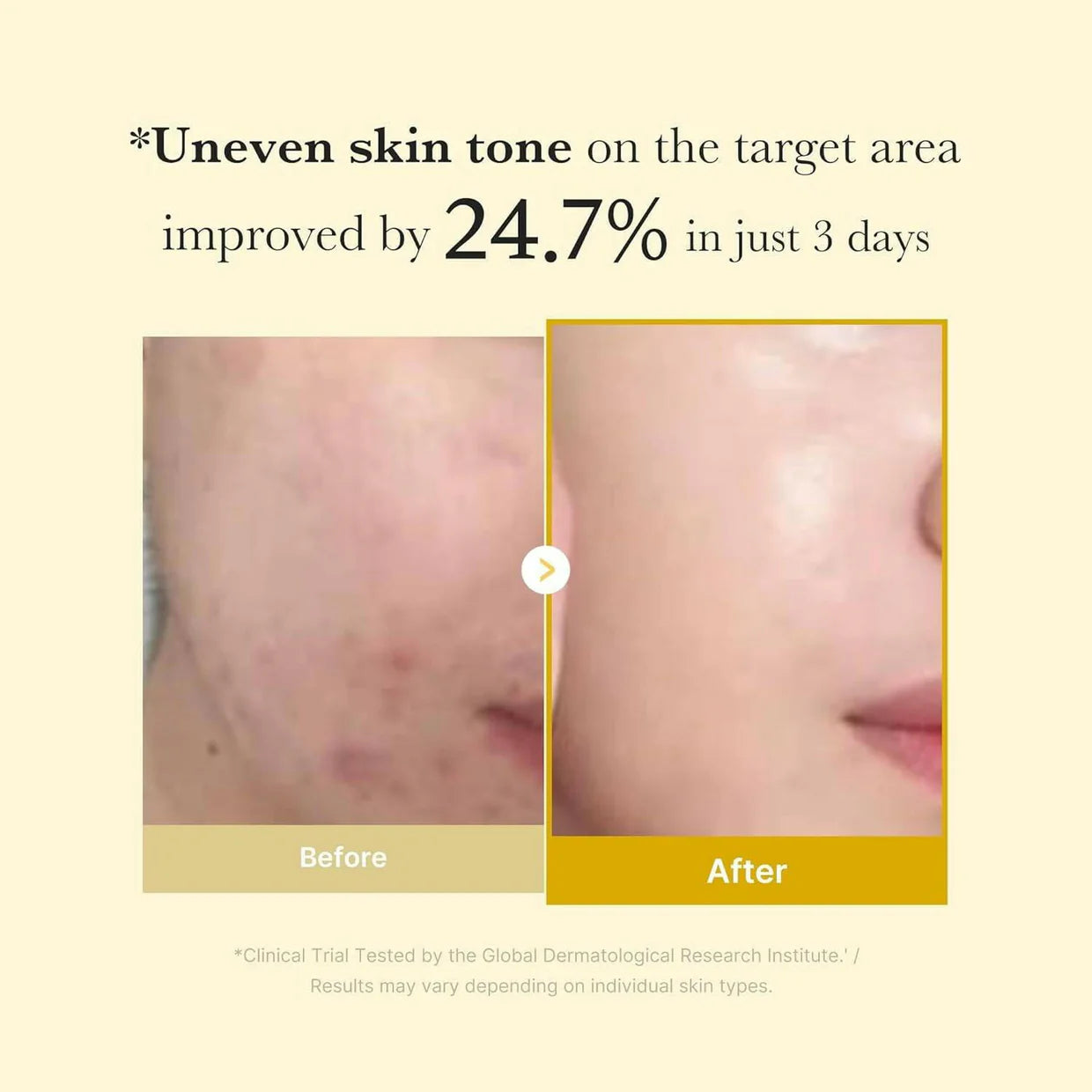 Medicube Kojic Acid Turmeric Night Wrapping Mask 75ml