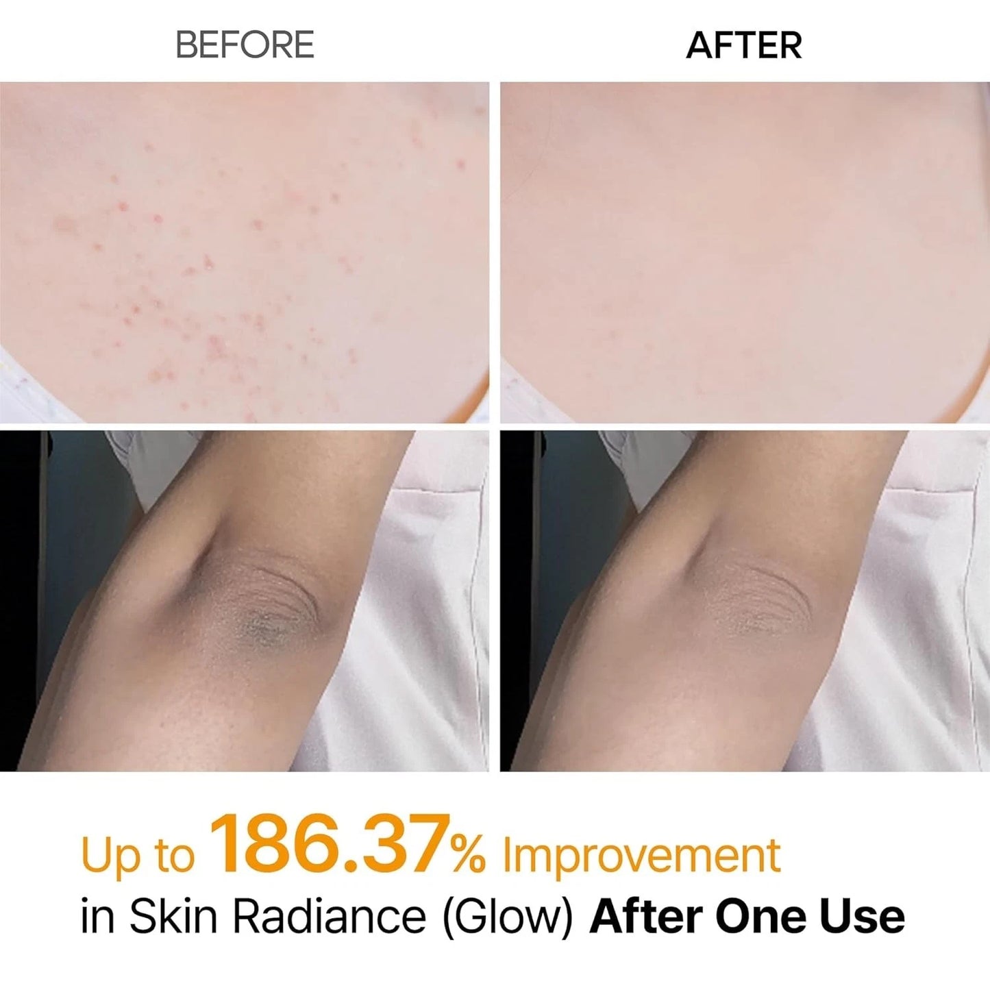 Dr. Melaxin Brightening Body Spray SET Kojic Acid + TXA 200ml × 2 (Full Size)