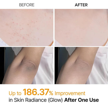 Dr. Melaxin Brightening Body Spray SET Kojic Acid + TXA 200ml × 2 (Full Size)