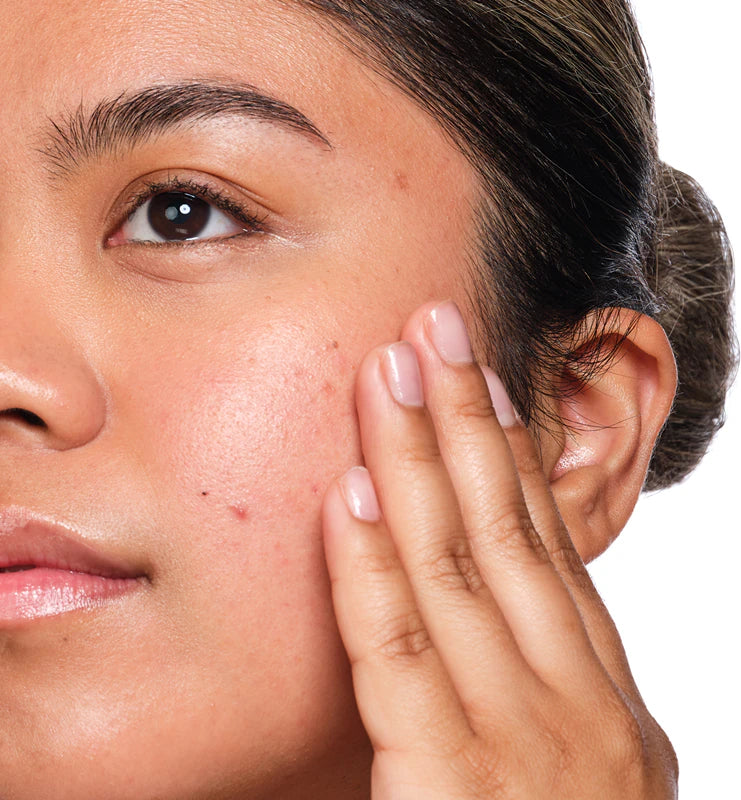 The Ordinary Salicylic Acid 2% Solution 30ml